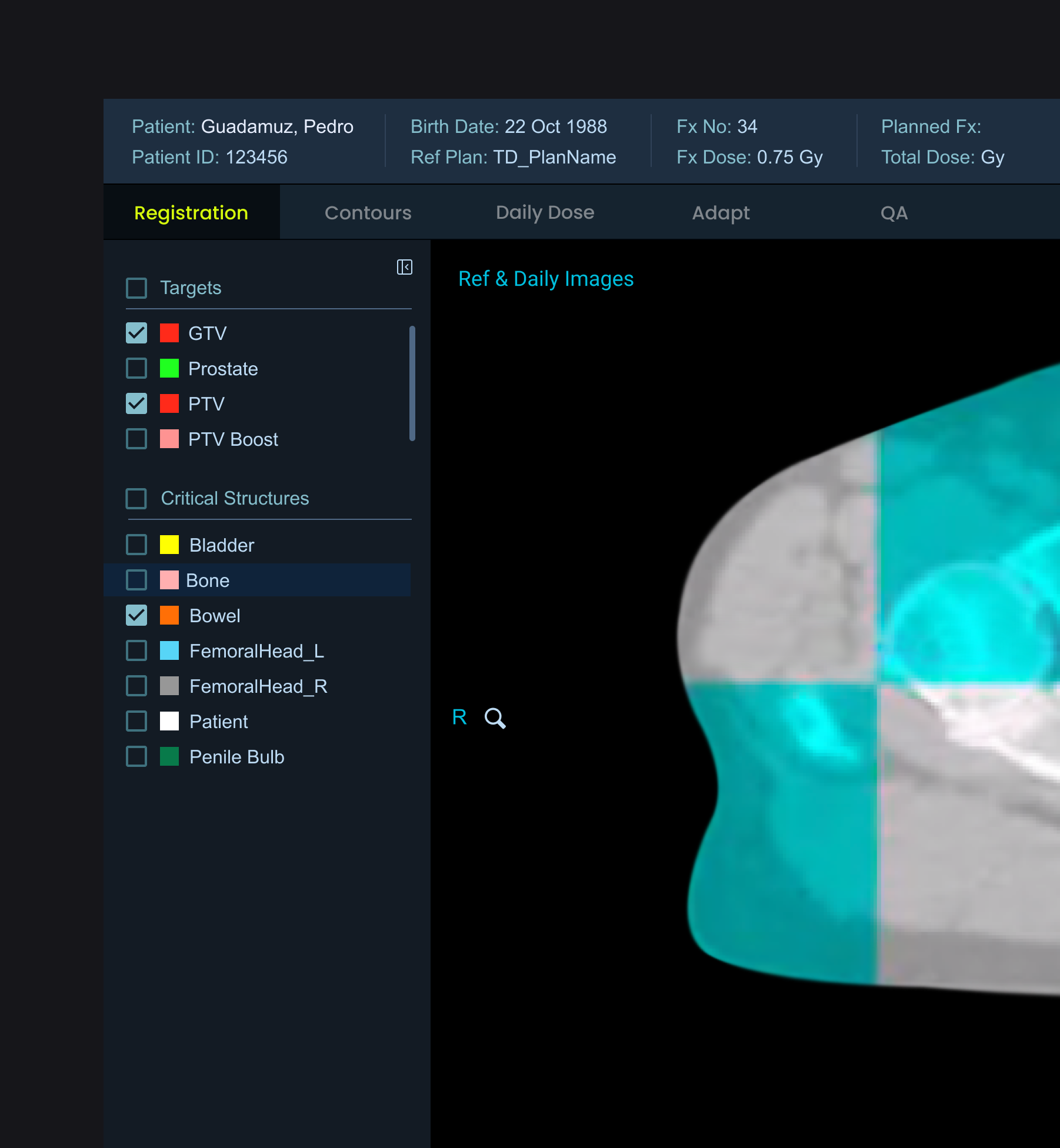 Giving the scan more room