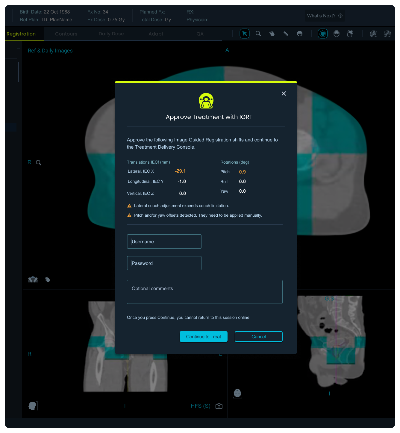 Accuray modal dialog